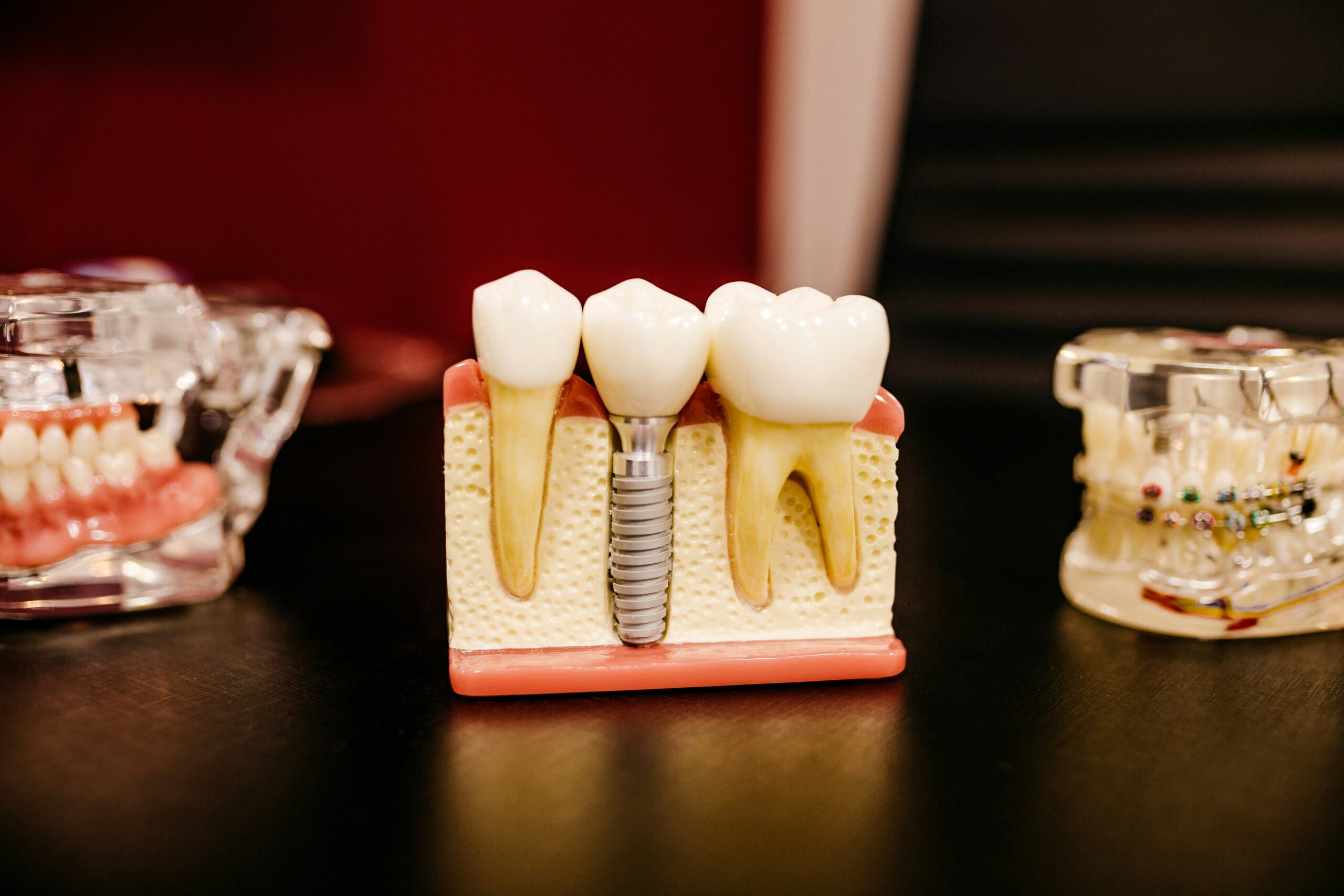 How Much Is a Dental Implant in 2026?